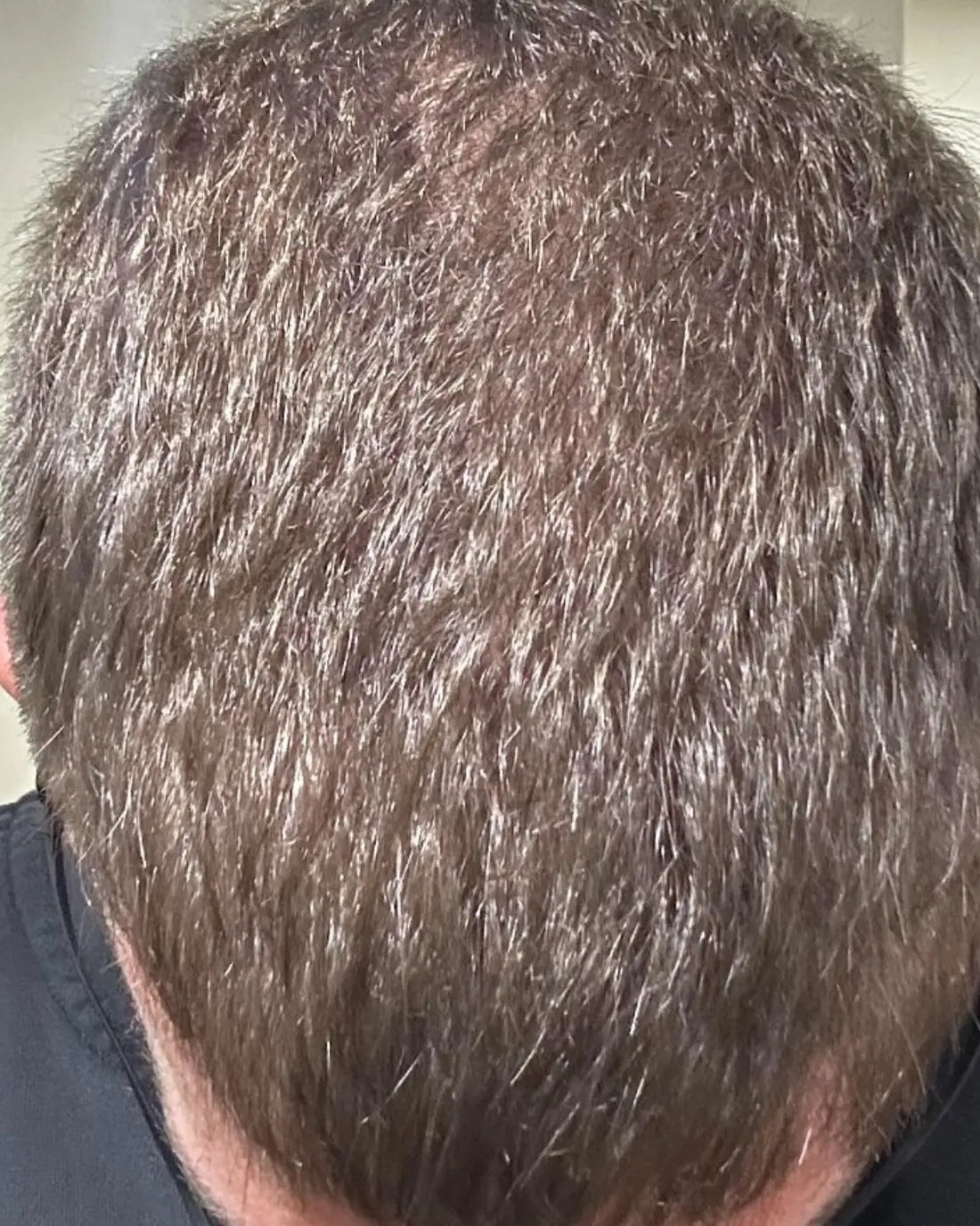 Same customer later, same angle: overall density