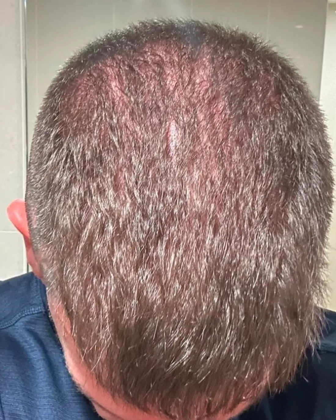 Customer photo before: overall density