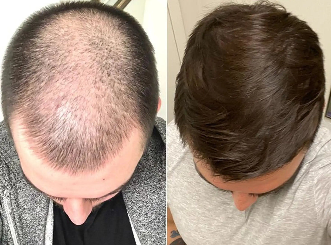 Before and after photo shared by Ryan P.