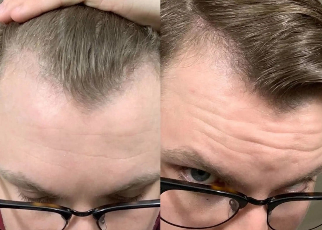 Before and after photo shared by Adam K.