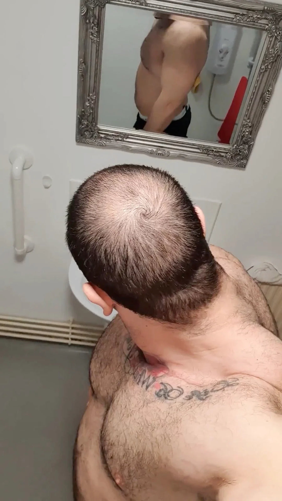 Result — before