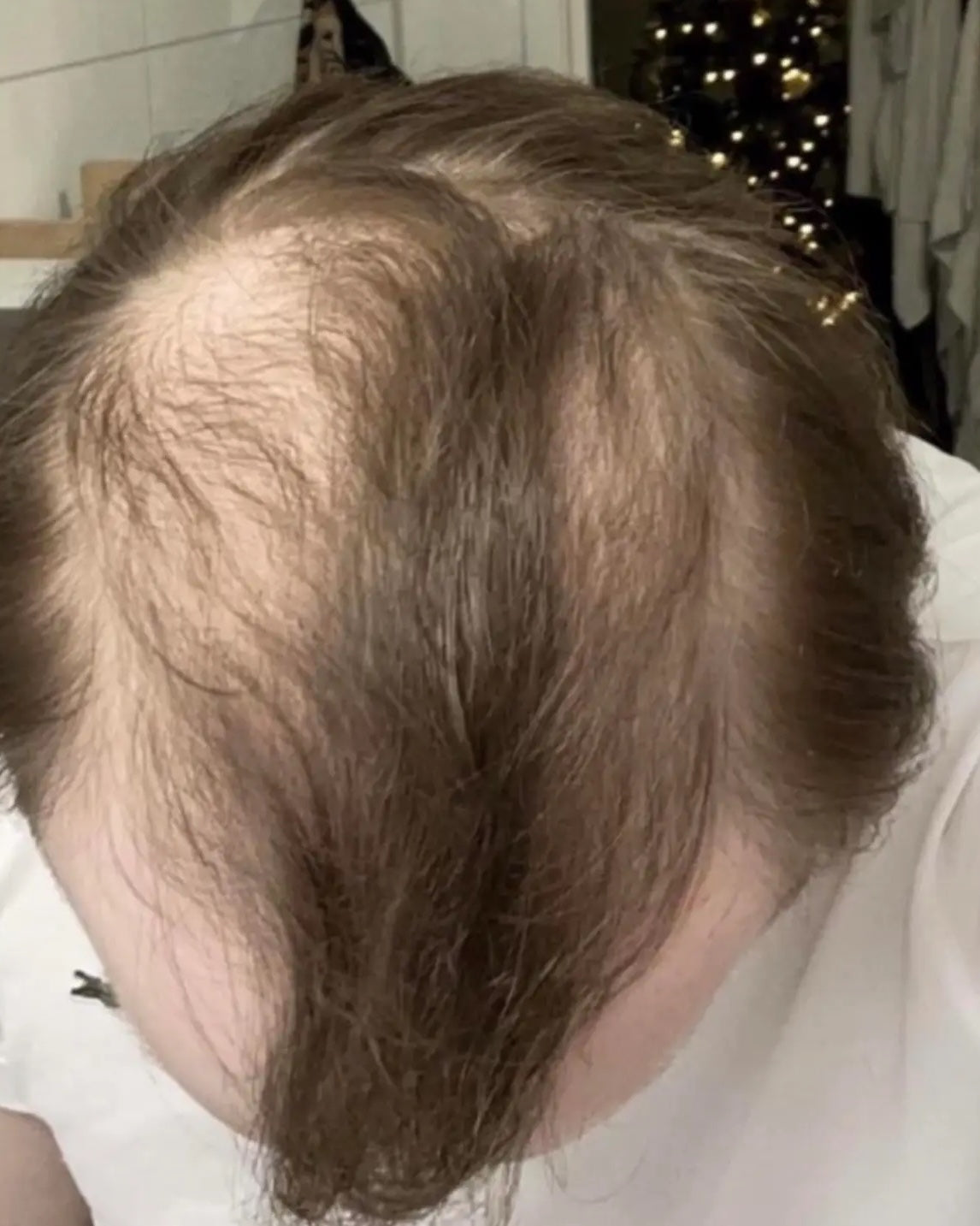 Crown coverage — Before