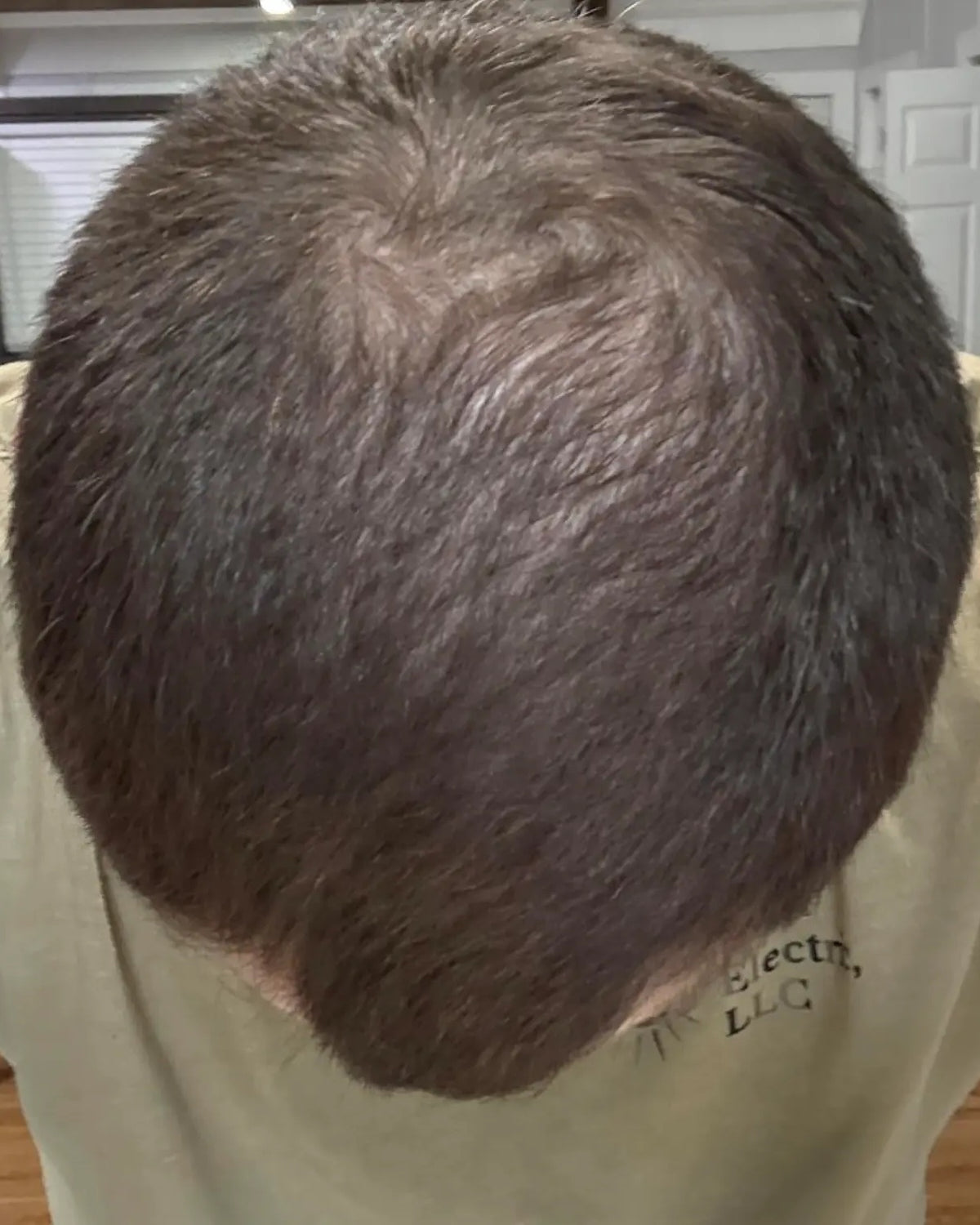 Crown density — After