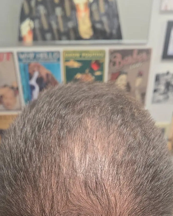 Crown — After