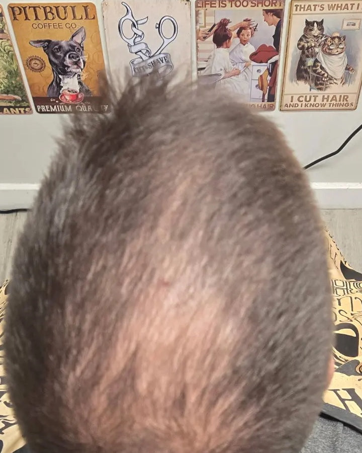 Crown — Before