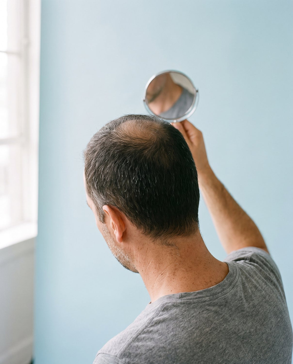 Why you are losing your hair: DHT, the androgen receptor, and what actually stops it