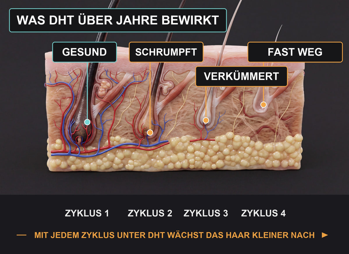 Warum Haare dünner werden
